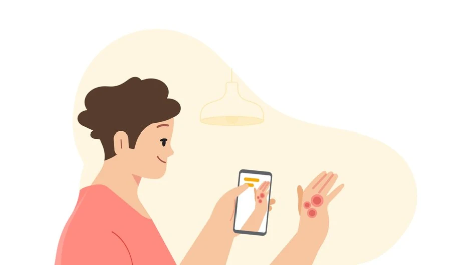 谷歌推出新功能，利用 AI 工具拍照检测皮肤病